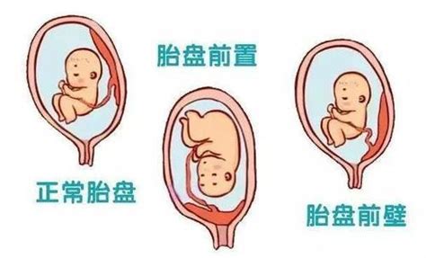 植入性胎盤 雛鳥視頻